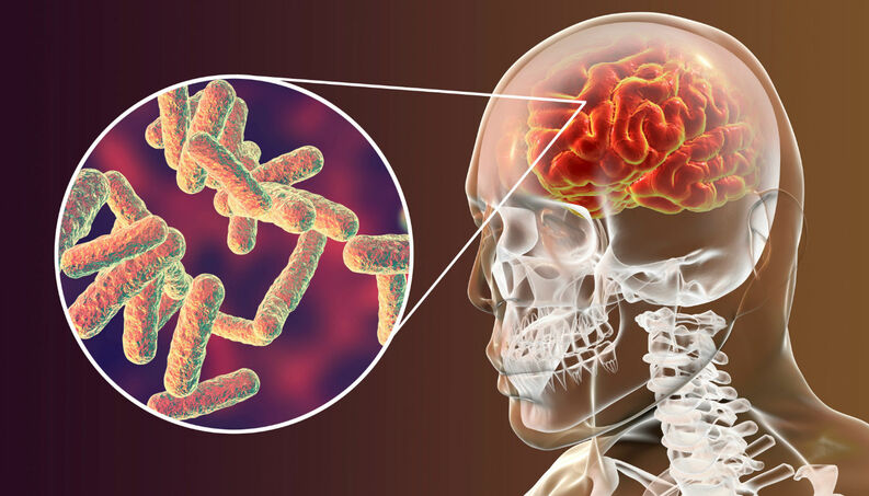 cerebro-bacteria-meningite-virus-cerebral-0518-1400x800 cerebro-bacteria-meningite-virus-cerebral-0518-1400x800