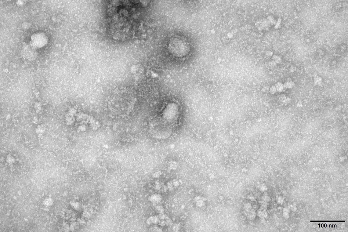 2020-01-27t142143z_1084473291_rc2eoe9edwa5_rtrmadp_3_china-health