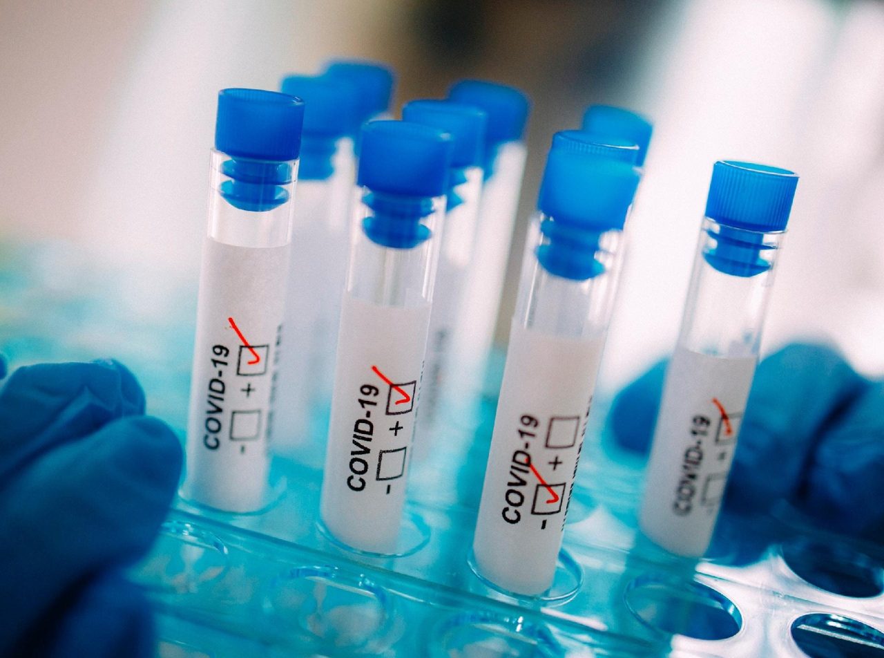 covid1242813875 covid1242813875