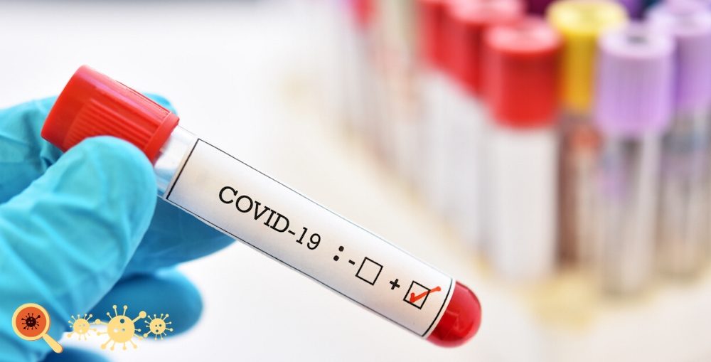 teste-covid-1000x509 teste-covid-1000x509