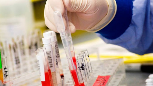 sangueexame413 sangueexame413