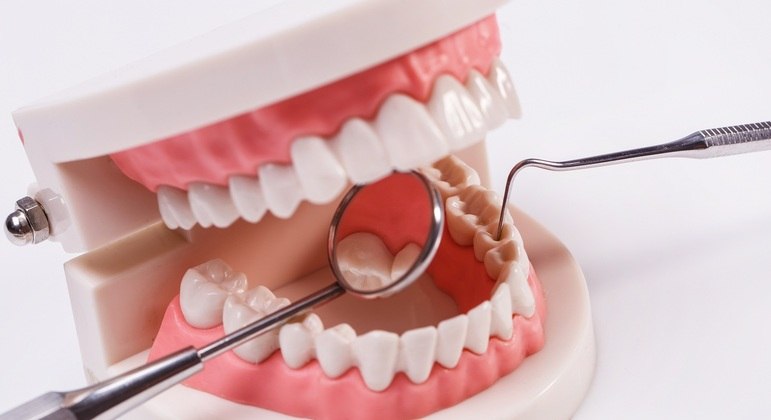 dentes-21042021121959606