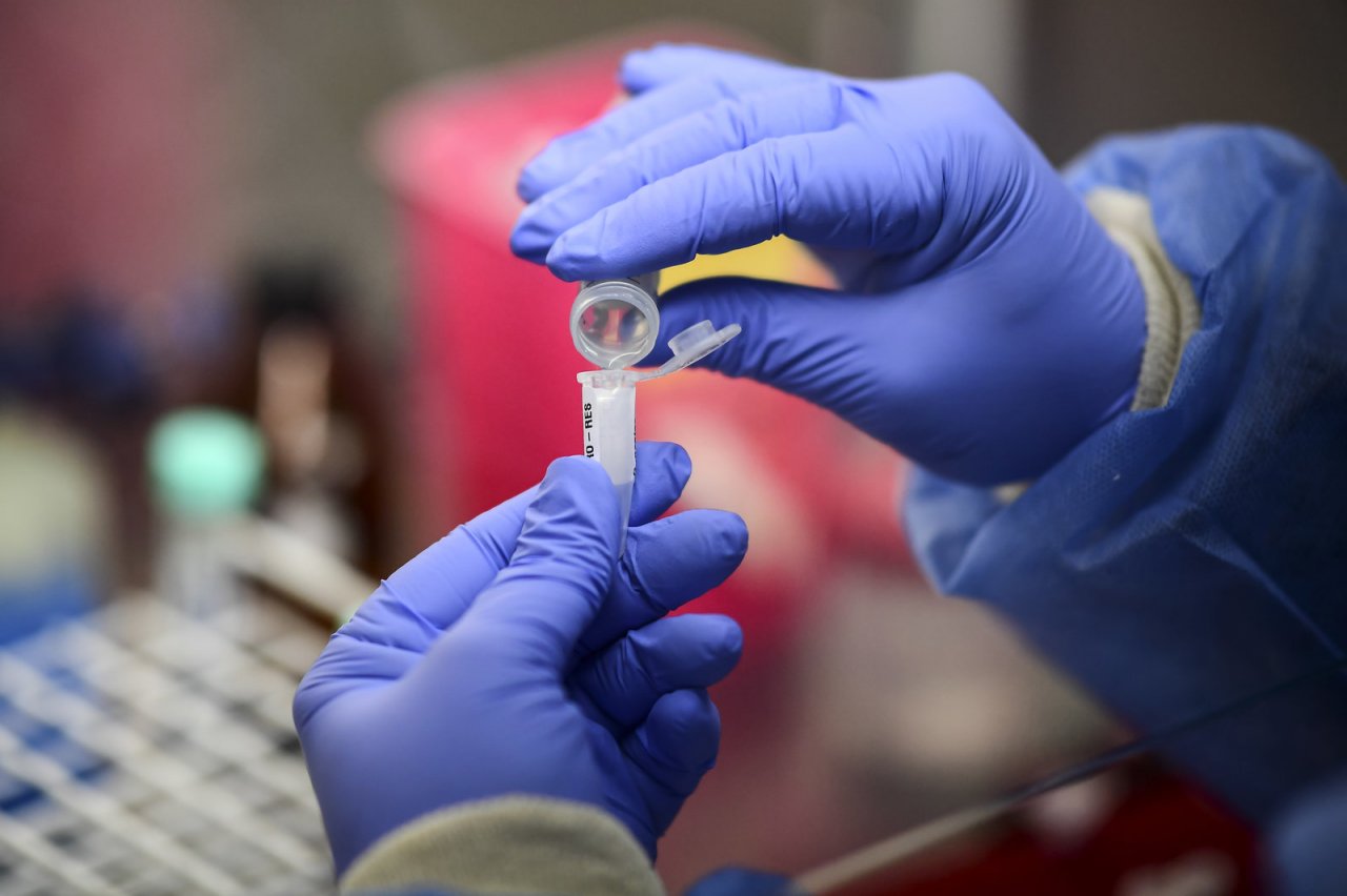 covidCorona1212794-19cepa covidCorona1212794-19cepa