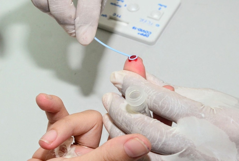 teste-covid-21809421 teste-covid-21809421