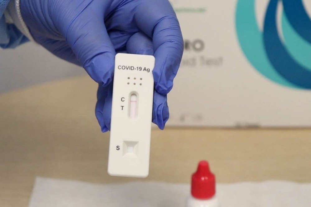 teste-covid-54872958 teste-covid-54872958