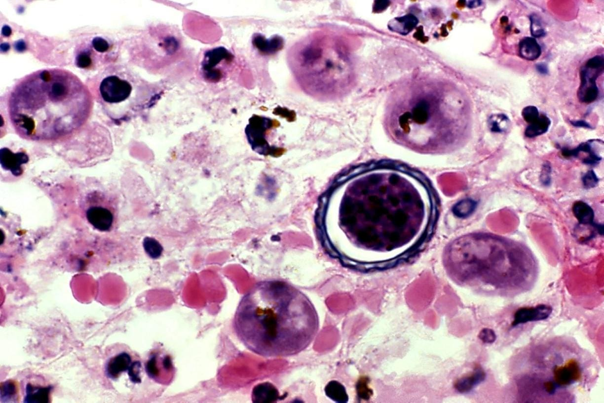 doença-bacteria-5-3c430f7b3e doença-bacteria-5-3c430f7b3e