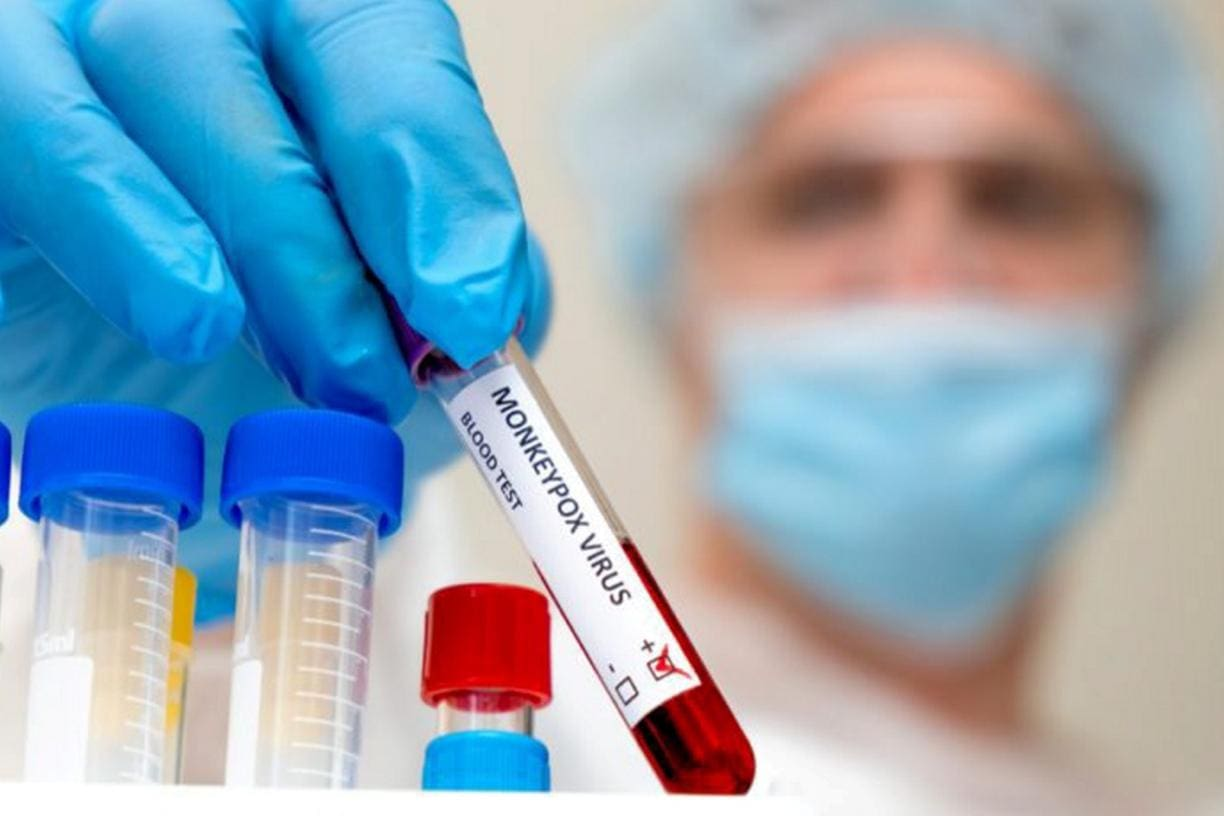 variola-5-e2c3813bb7