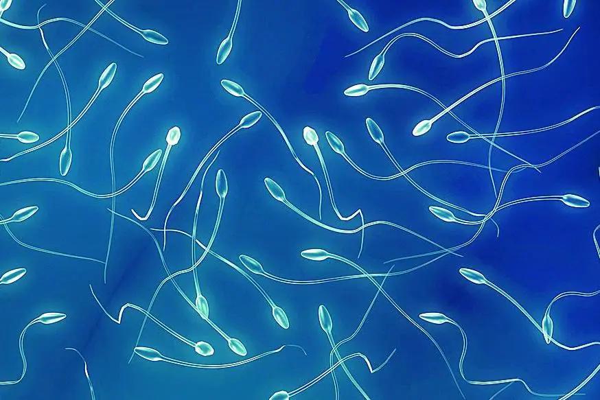 espermatozoides-4-a425cb1b82 espermatozoides-4-a425cb1b82