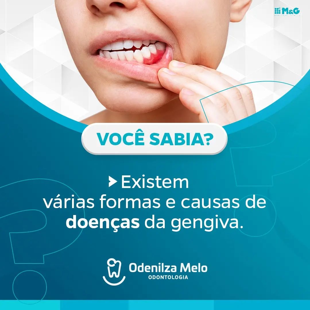 Odenilza301222 Odenilza301222