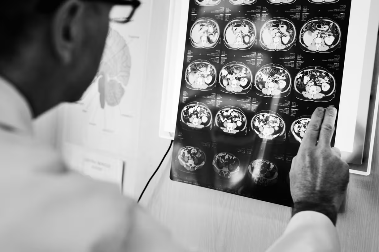 medico-exame-derrame-5-05bf66e350 medico-exame-derrame-5-05bf66e350