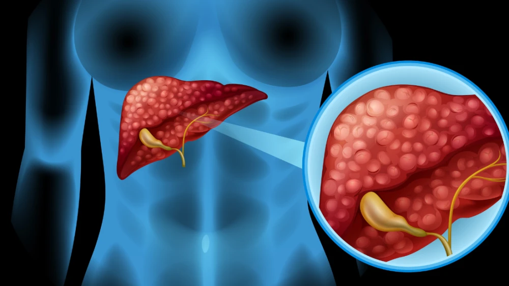 figado-3258527