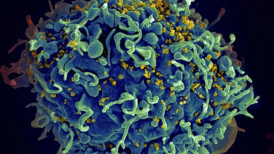 hiv-infecting-a-human-cell-20683459455--960x540 hiv-infecting-a-human-cell-20683459455--960x540