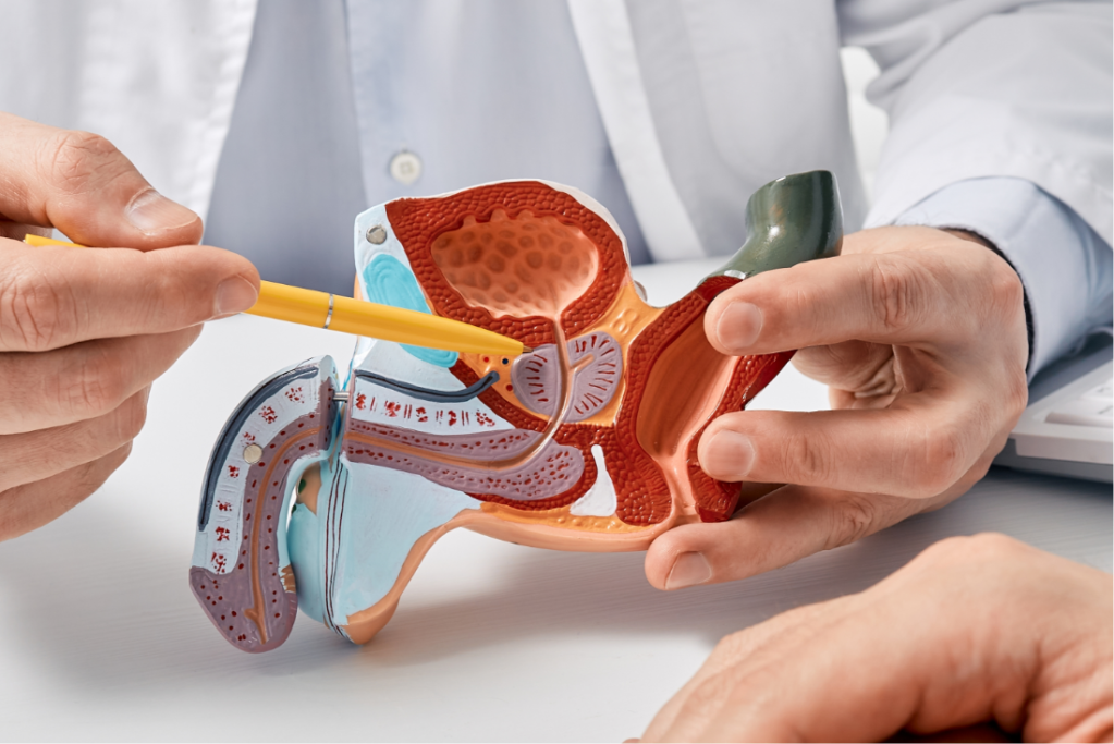 cancer-prostata-2358