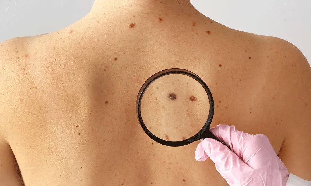 ezgif-4-ecf45d6011 ezgif-4-ecf45d6011