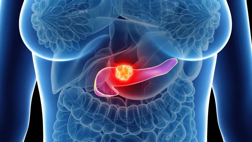 ezgif-2e8f614623c3ae