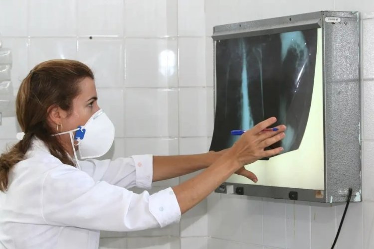 Uberlândia tem 49 casos de tuberculose