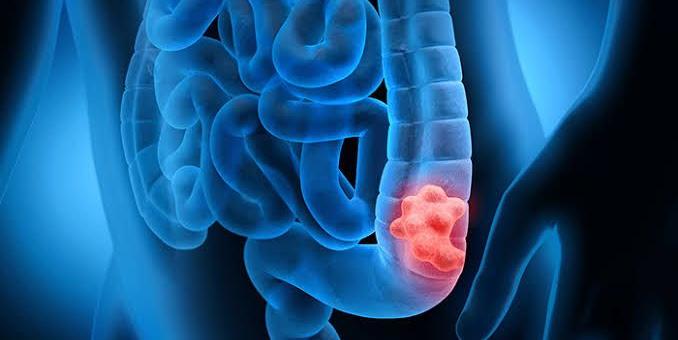 intestino-643585 intestino-643585