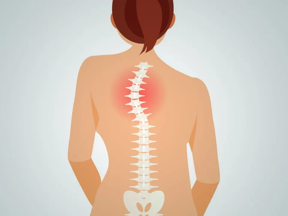 artigo-escoliose-capa