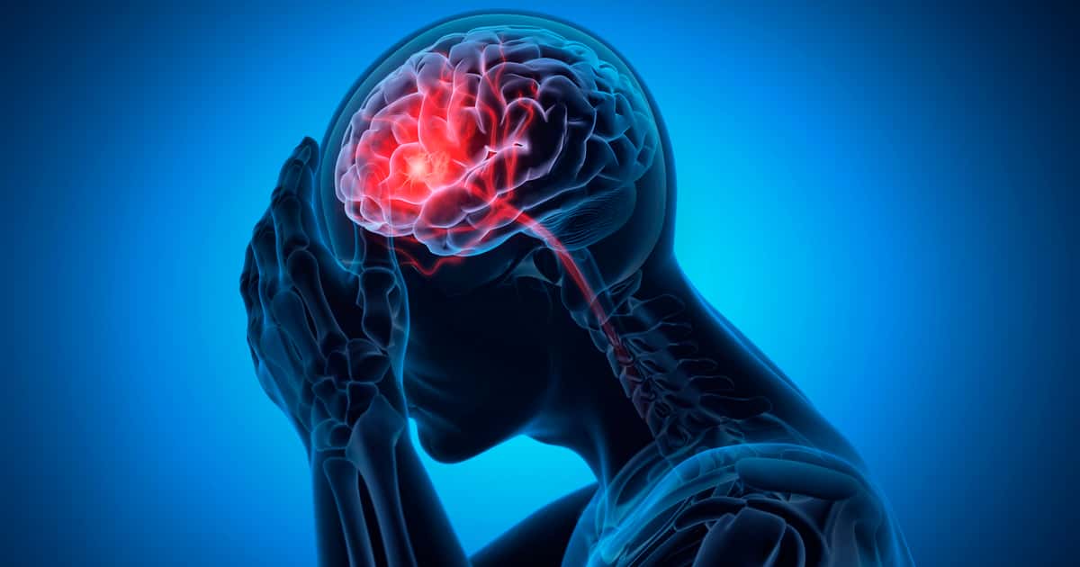 cerebro-avc-1927703857