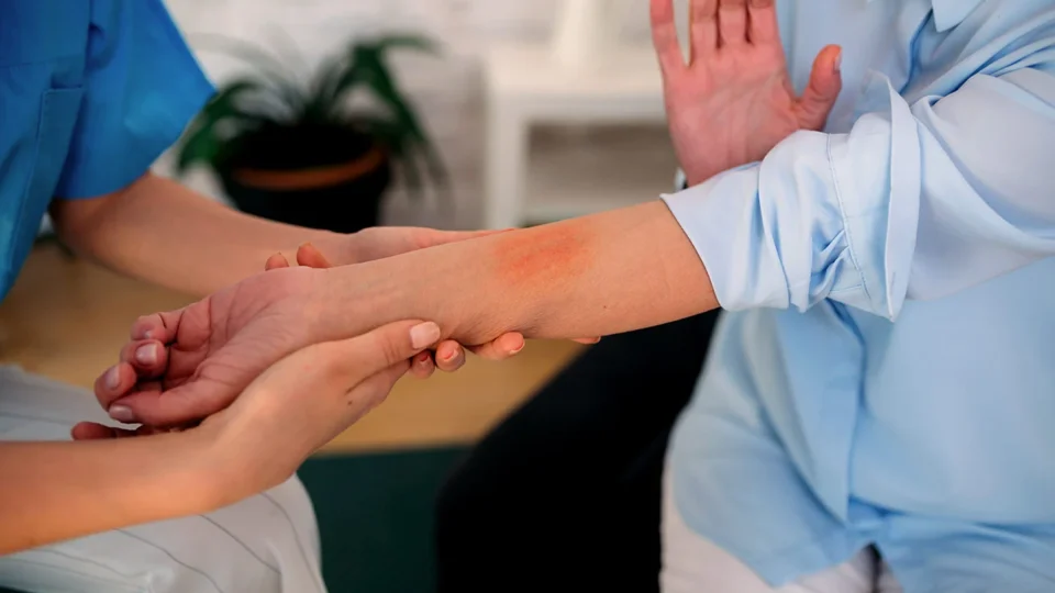 113-queimaduras-960x540