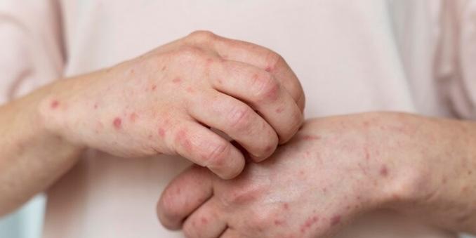 40528609989864283780427