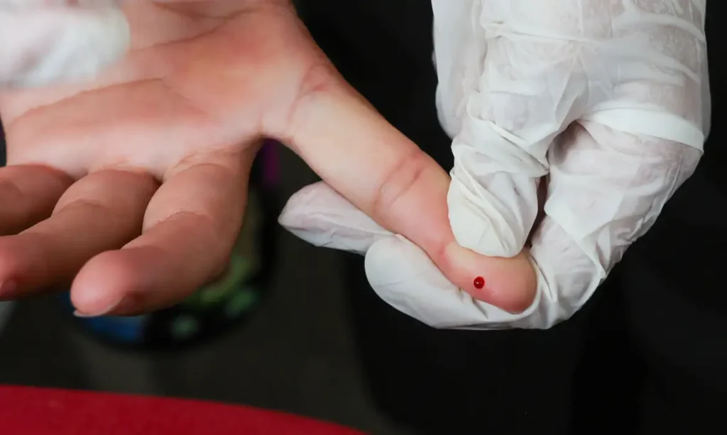 SUS passa a oferecer teste rápido de dengue