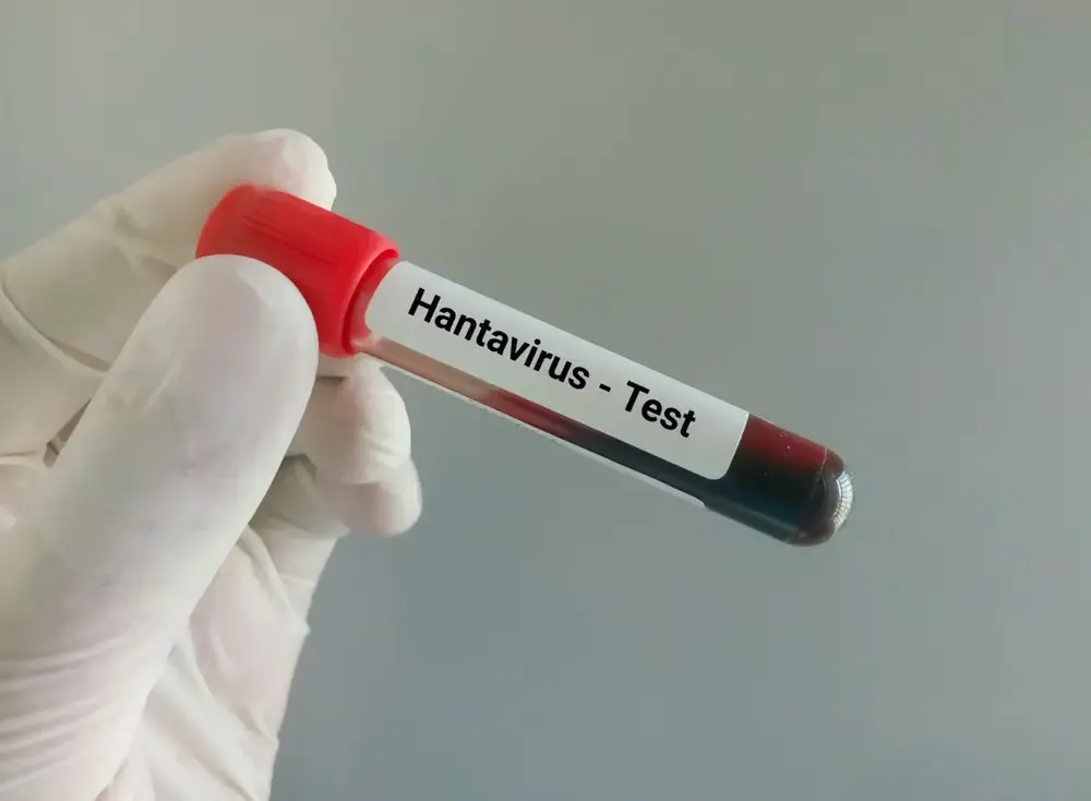 hantavirus -4e0cbe65ded219a4