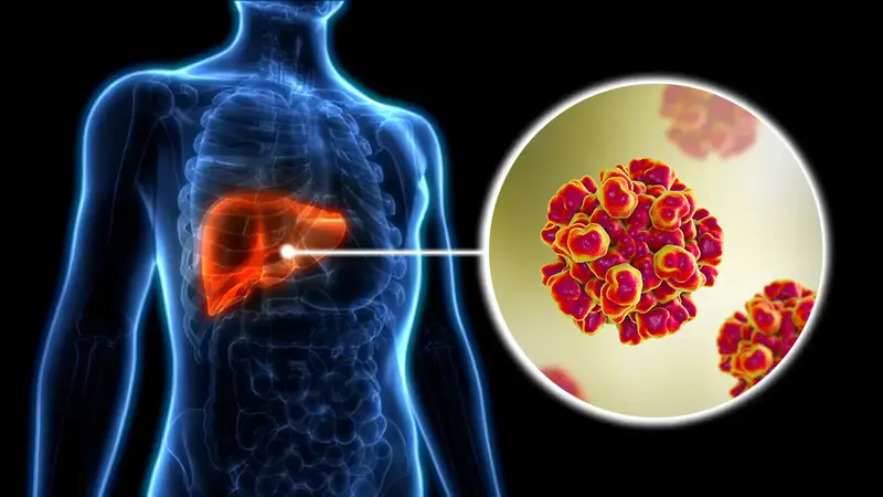 75% das mortes por hepatite vêm de um vírus que hoje tem cura: Por que o diagnóstico precoce muda o jogo