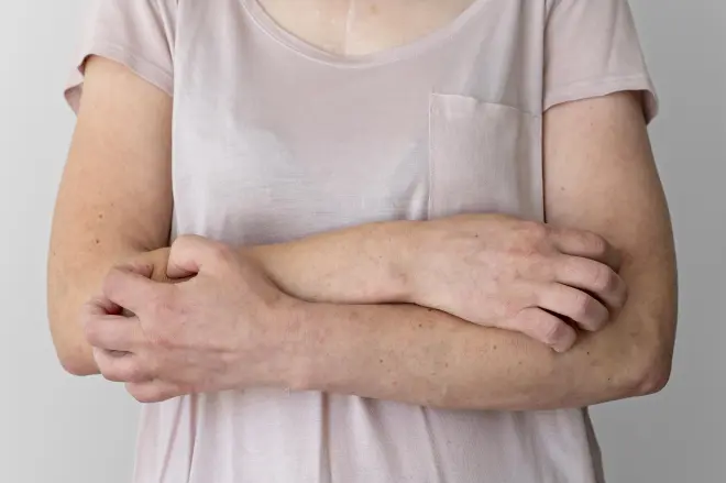 skin-allergy-reaction-person-s-arm skin-allergy-reaction-person-s-arm